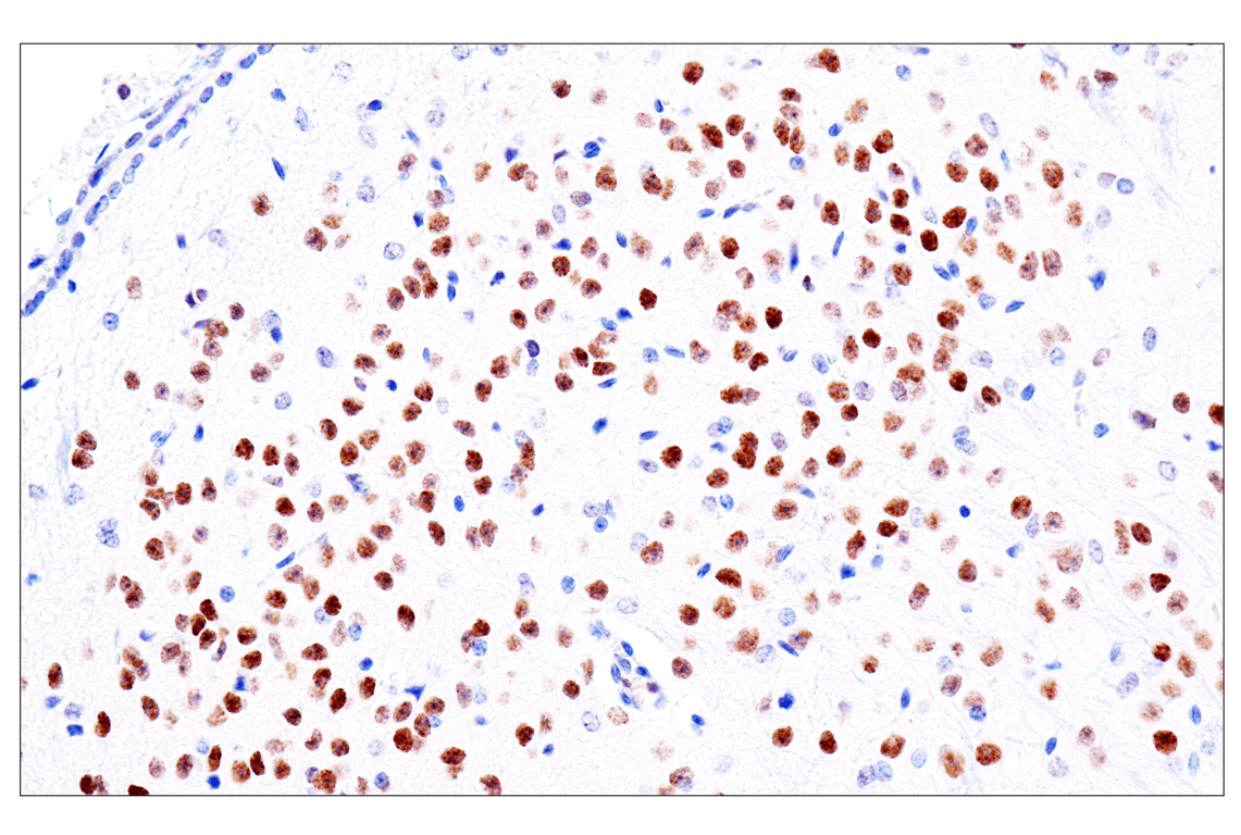 Immunohistochemistry Image 22: GATA-6 (D61E4) Rabbit Monoclonal Antibody