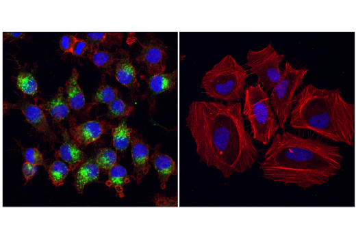 Immunofluorescence Image 1: VISTA (D5L5T) Rabbit Monoclonal Antibody (BSA and Azide Free)