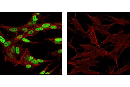 Immunofluorescence Image 1: AP-2 beta Antibody