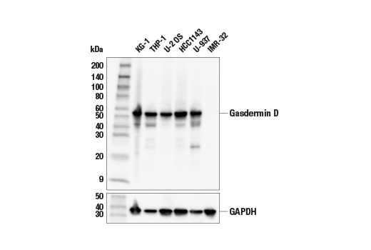 undefined Image 11: Gasdermin Family Antibody Sampler Kit