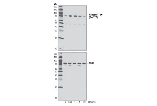 undefined Image 6: Xenophagy Antibody Sampler Kit