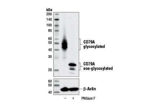 Western Blotting Image 2: CD79A (D1X5C) Rabbit Monoclonal Antibody