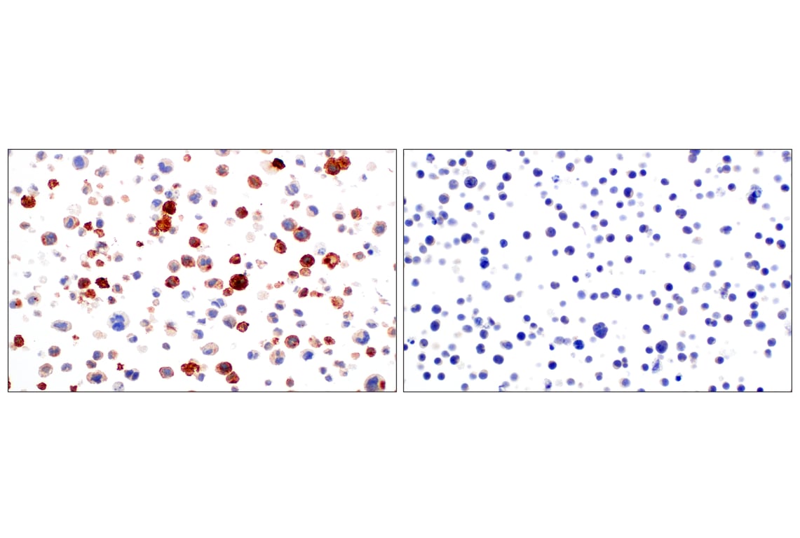 Immunohistochemistry Image 16: CD11b/ITGAM (E3J2F) Rabbit Monoclonal Antibody