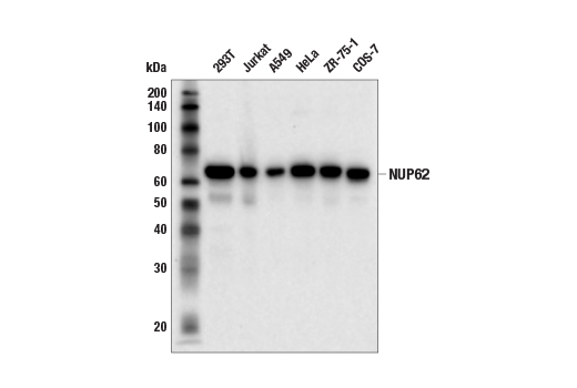 Western Blotting Image 2: NUP62 (E7H9O) Rabbit Monoclonal Antibody