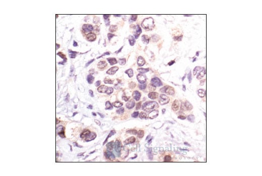 Immunohistochemistry Image 1: p21 Waf1/Cip1 (DCS60) Mouse Monoclonal Antibody