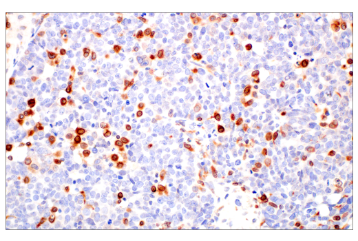 Immunohistochemistry Image 5: HO-1 (E8B7A) XP<sup>®</sup> Rabbit mAb (BSA and Azide Free)