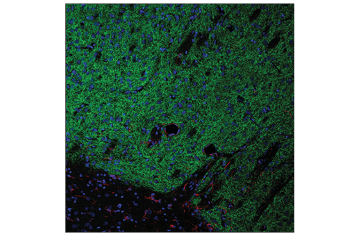 Immunofluorescence Image 1: Adora2a/Adenosine Receptor A2a (E5I8X) XP<sup>®</sup> Rabbit mAb