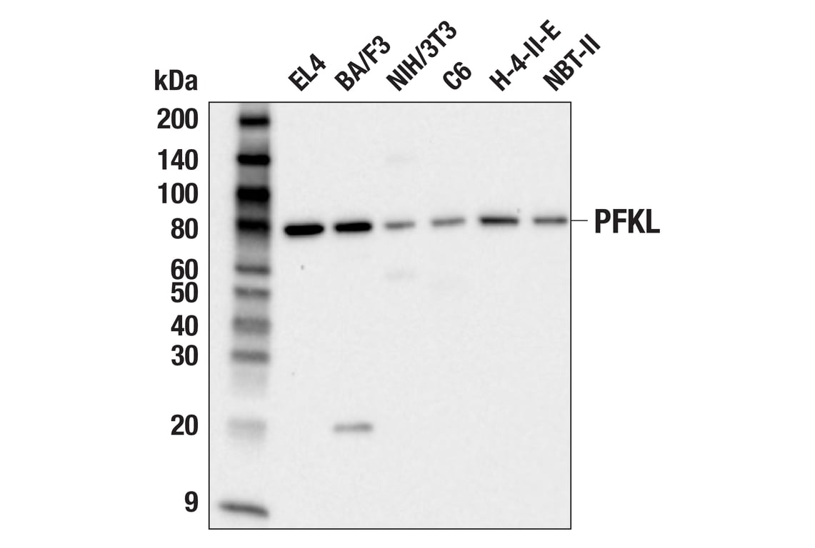 Western Blotting Image 3: PFKL (E7G5O) Rabbit Monoclonal Antibody