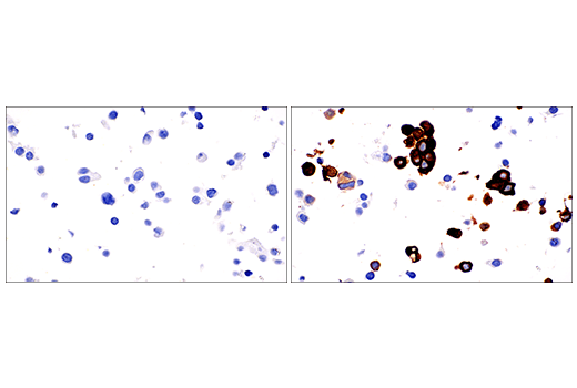 Immunohistochemistry Image 1: CD103/ITGAE (EP206) Rabbit Monoclonal Antibody