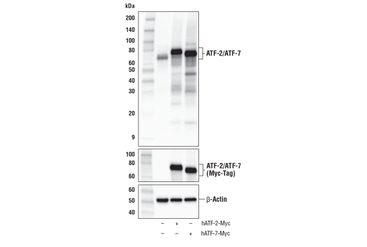 Western Blotting Image 2: ATF-2/ATF-7 (A9G1M) Rabbit Monoclonal Antibody