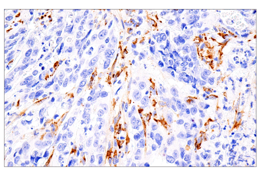 Immunohistochemistry Image 1: COL5A1 (E6U9W) Rabbit Monoclonal Antibody