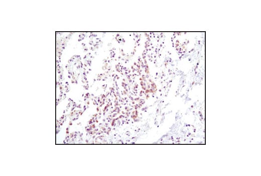 Immunohistochemistry Image 2: Jak2 (D2E12) Rabbit Monoclonal Antibody (BSA and Azide Free)