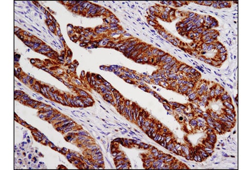 Immunohistochemistry Image 2: Cox2 (D5H5) Rabbit Monoclonal Antibody (BSA and Azide Free)