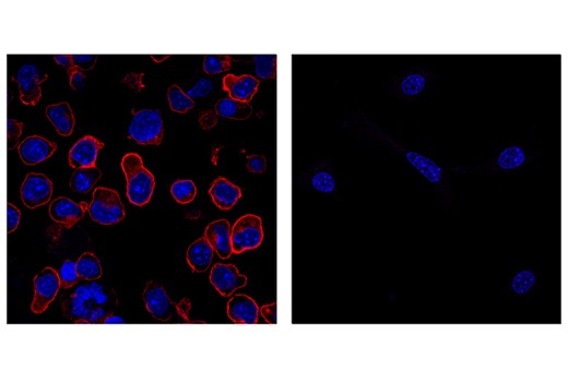 Immunofluorescence Image 1: PD-1 (Intracellular Domain) (D7D5W) Rabbit Monoclonal Antibody (Alexa Fluor<sup>®</sup> 647 Conjugate)