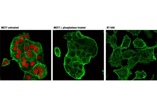 Immunofluorescence Image 1: Phospho-Rb (Ser807/811) (D20B12) XP<sup>®</sup> Rabbit mAb (Alexa Fluor<sup>®</sup> 555 Conjugate)