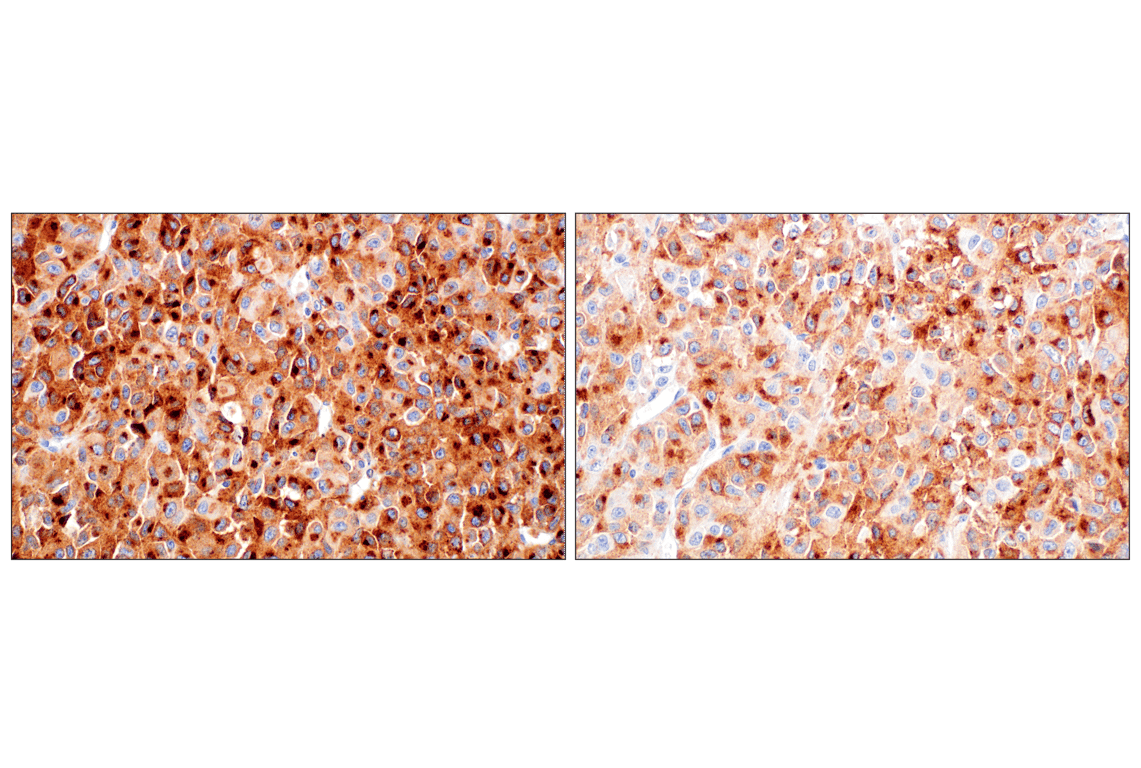 Immunohistochemistry Image 5: DLK1 (F7O3Q) Rabbit Monoclonal Antibody