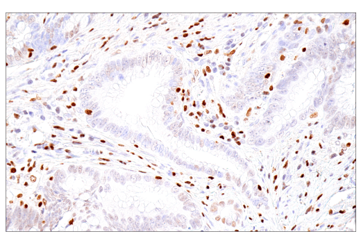 Immunohistochemistry Image 5: RUNX3/AML2 (E8D5W) Rabbit Monoclonal Antibody
