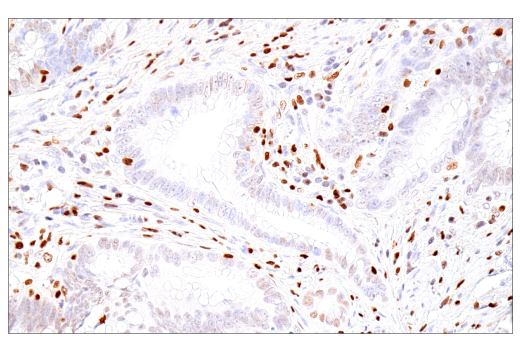 Immunohistochemistry Image 5: RUNX3/AML2 (E8D5W) XP<sup>®</sup> Rabbit mAb