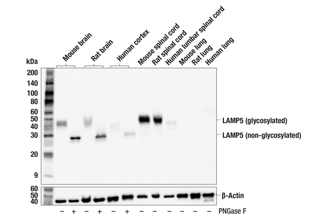 Western Blotting Image 2: LAMP5 (F9Q8X) Rabbit Monoclonal Antibody