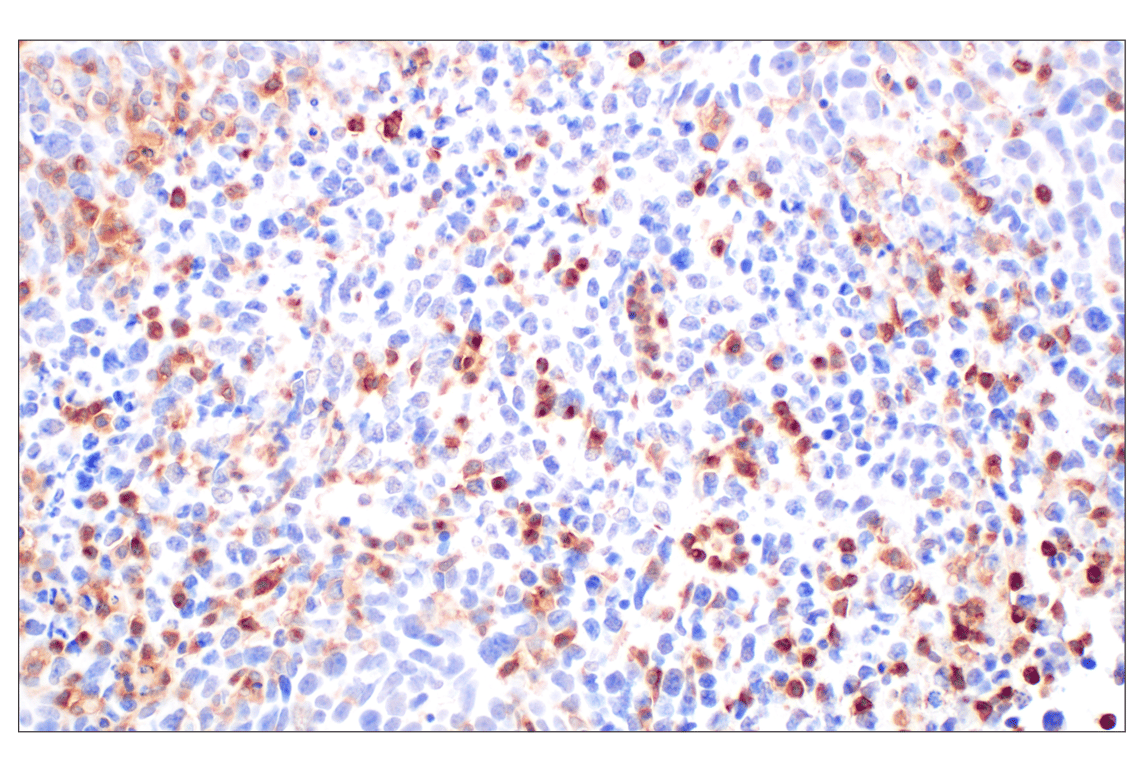 Immunohistochemistry Image 2: DAP12 (F1Q2P) Rabbit Monoclonal Antibody