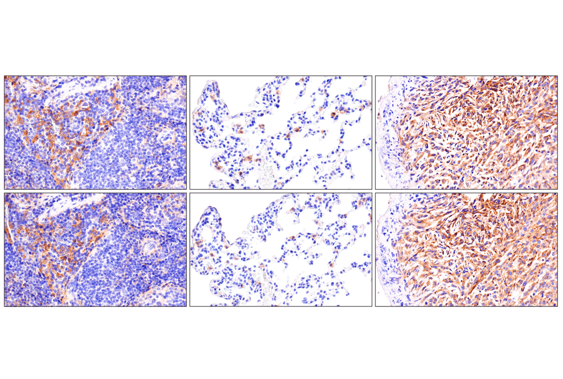 まとめ　c45 e96 Overexpression of 4EBP1, p70S6K, Akt1 or Akt2 differentially