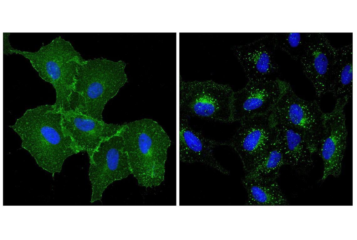 Immunofluorescence Image 1: EGF Receptor (D38B1) Rabbit Monoclonal Antibody