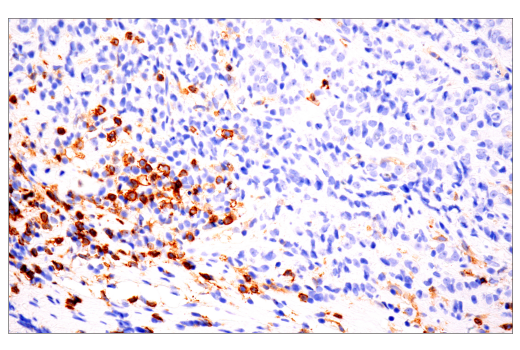 Immunohistochemistry Image 2: CD4 (EP204) Rabbit Monoclonal Antibody