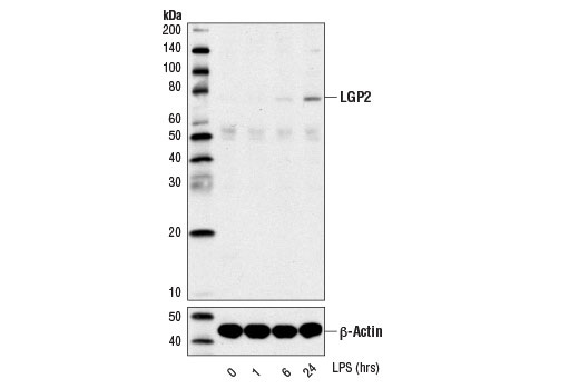 Western Blotting Image 2: LGP2 (D3I3L) Rabbit Monoclonal Antibody