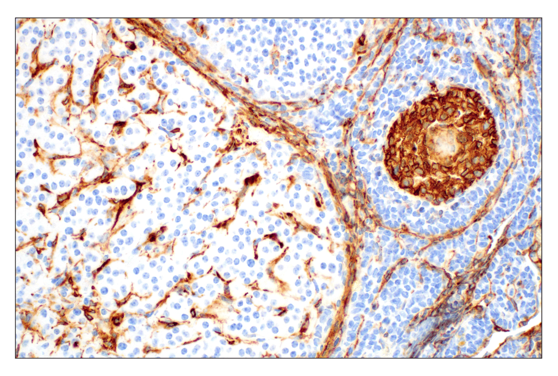 Immunohistochemistry Image 6: alpha-Smooth Muscle Actin (1A4) Mouse Monoclonal Antibody (BSA and Azide Free)