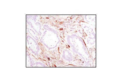 Immunohistochemistry Image 1: Caveolin-1 (D46G3) Rabbit Monoclonal Antibody
