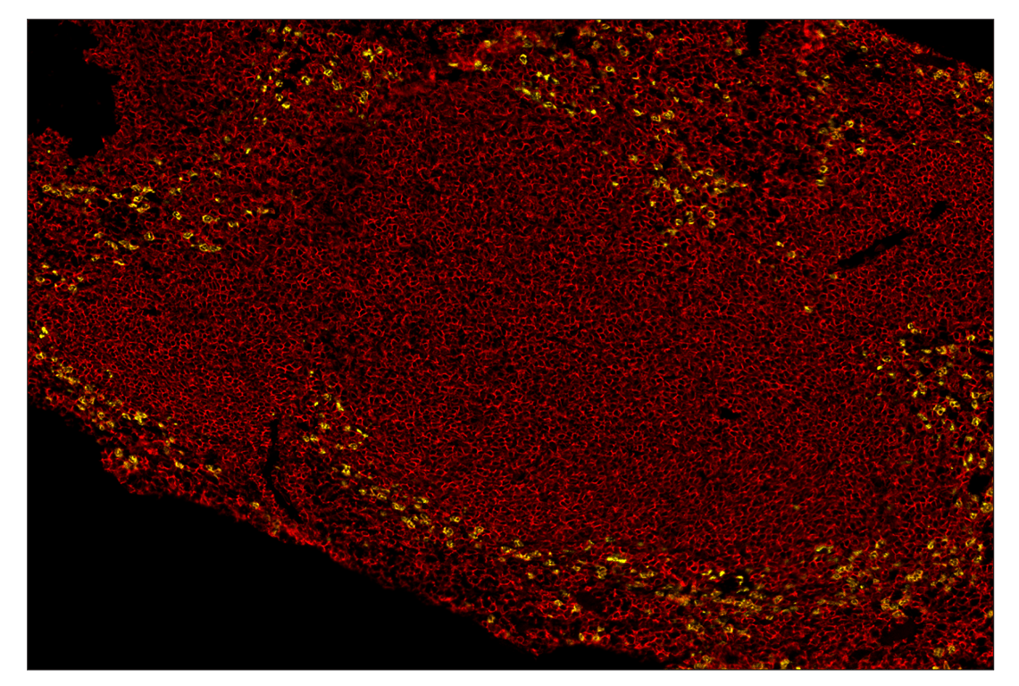 Immunohistochemistry Image 1: CD45 (D3F8Q) & CO-0046-750 SignalStar<sup>™</sup> Oligo-Antibody Pair