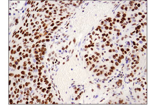 Immunohistochemistry Image 2: Brg1 (E8V5B) Mouse Monoclonal Antibody (BSA and Azide Free)