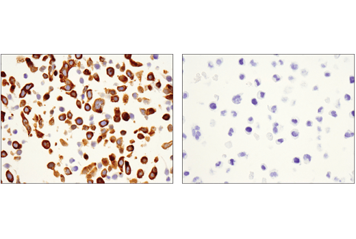 Immunohistochemistry Image 5: FAK (D5O7U) Rabbit Monoclonal Antibody