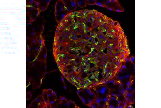 Immunofluorescence Image 1: VEGF Receptor 2 (55B11) Rabbit Monoclonal Antibody (BSA and Azide Free)