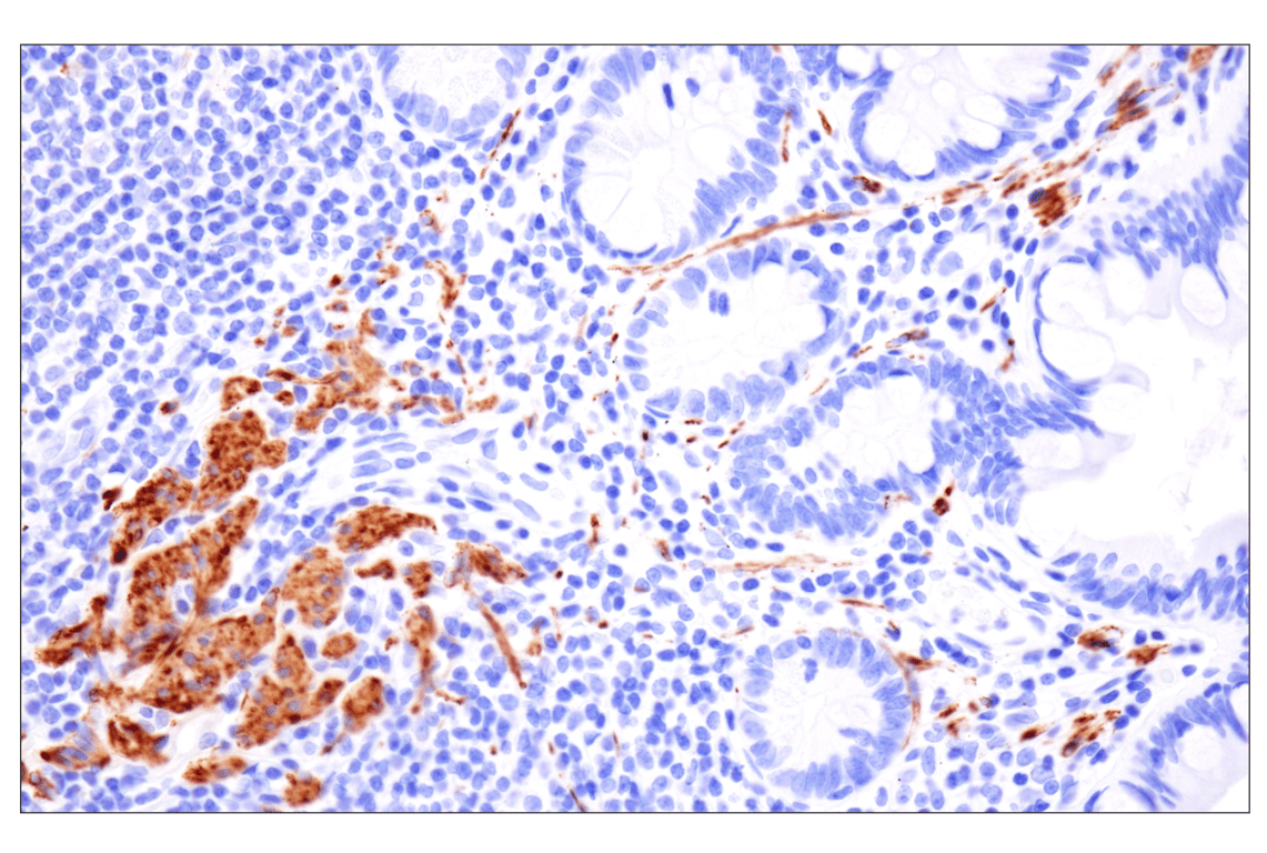 Immunohistochemistry Image 8: Desmin (F5V4I) Rabbit Monoclonal Antibody