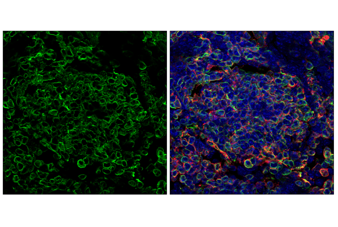 Immunofluorescence Image 3: CD74 (F6K1S) Rabbit Monoclonal Antibody