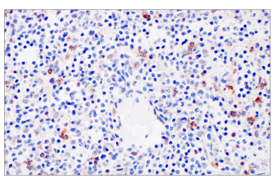 Immunohistochemistry Image 10: HLA-DRA (E9R2Q) Rabbit Monoclonal Antibody