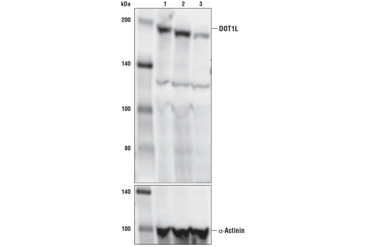 Western Blotting Image 2: DOT1L (D4O2T) Rabbit Monoclonal Antibody