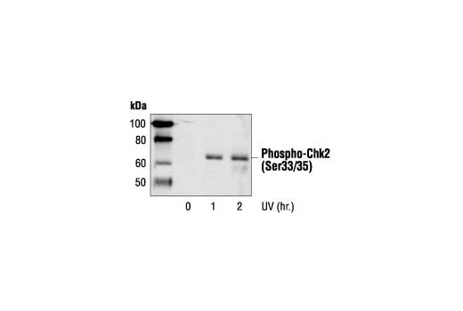 Phospho-Chk2 (Ser33/35) Antibody | Cell Signaling Technology