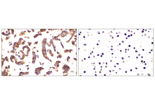 Immunohistochemistry Image 2: Glut1 (E4S6I) Rabbit Monoclonal Antibody