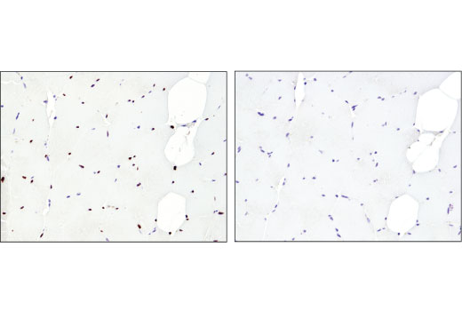 Immunohistochemistry Image 6: SIX1 (D5S2S) Rabbit Monoclonal Antibody