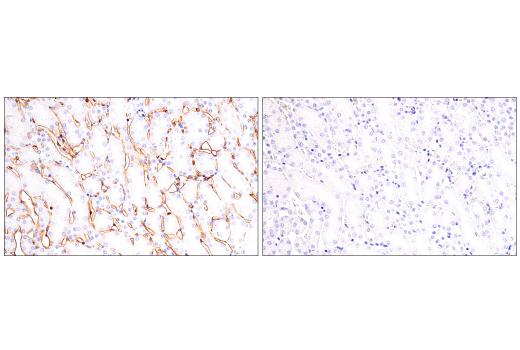 Immunohistochemistry Image 6: PLVAP (E4U6V) Rabbit Monoclonal Antibody