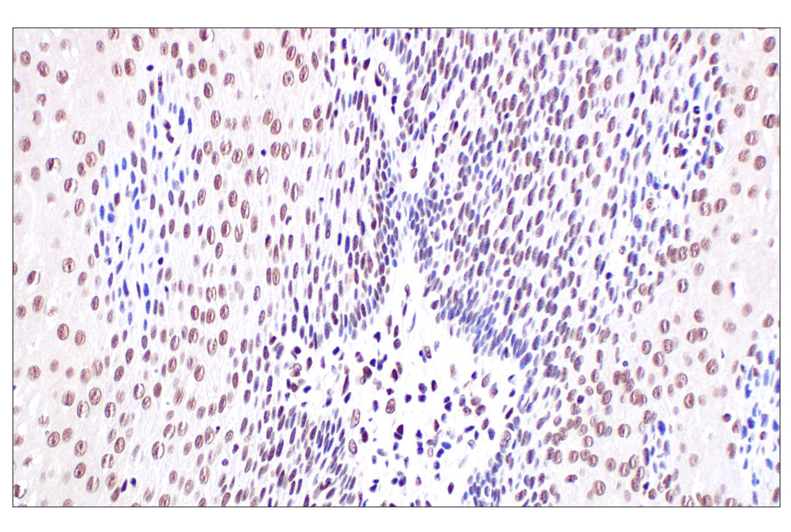 undefined Image 28: PPAR gamma Regulated Fatty Acid Metabolism Antibody Sampler Kit