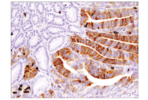 Immunohistochemistry Image 1: DCLK1/DCAMKL1 (D2U3L) Rabbit Monoclonal Antibody
