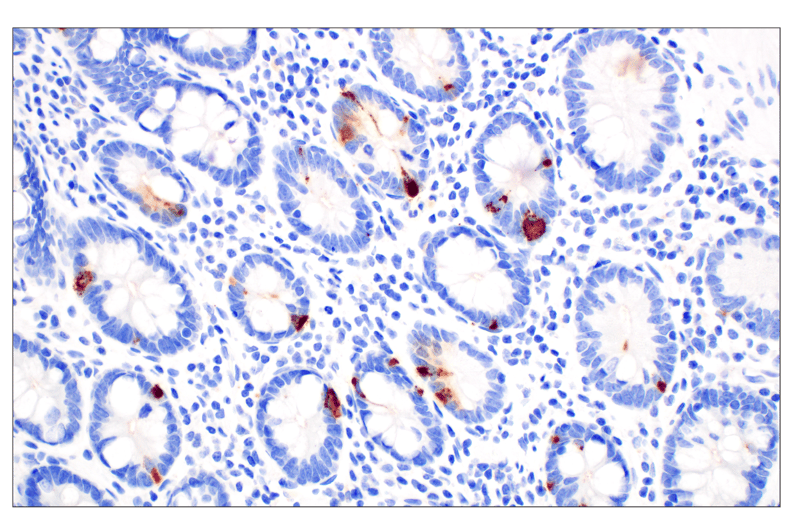 Immunohistochemistry Image 3: CHGA (F7D6H) Rabbit Monoclonal Antibody (BSA and Azide Free)