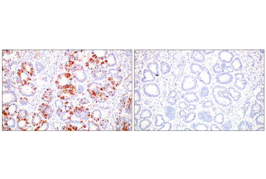 Immunohistochemistry Image 7: Phospho-CrkL (Tyr207) (E9A1U) Rabbit Monoclonal Antibody (BSA and Azide Free)