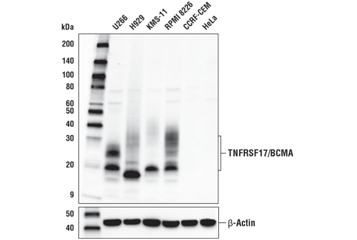 Western Blotting Image 2: TNFRSF17/BCMA (E6D7B) Rabbit Monoclonal Antibody