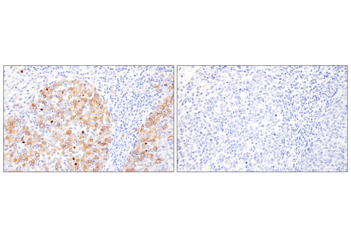 Immunohistochemistry Image 10: Eg5 (E1L3W) Rabbit Monoclonal Antibody