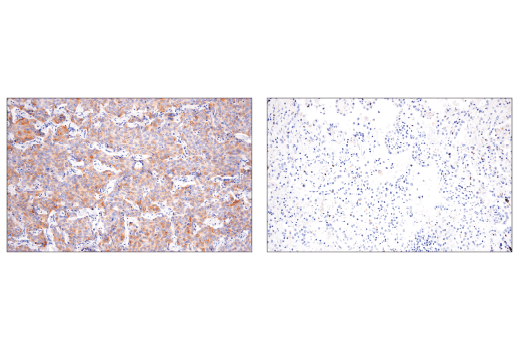 Immunohistochemistry Image 3: DLL3 (E3J5R) Rabbit Monoclonal Antibody