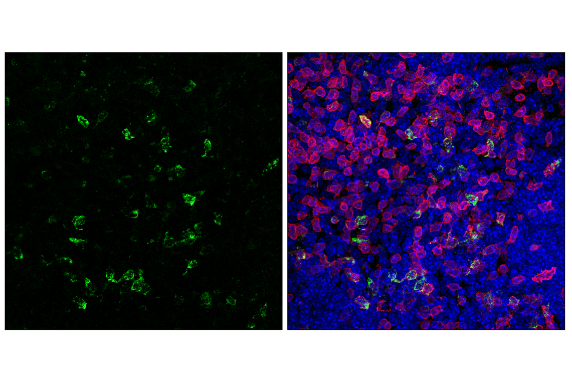 Immunofluorescence Image 2: CTLA-4 (E2V1Z) Rabbit Monoclonal Antibody (BSA and Azide Free)